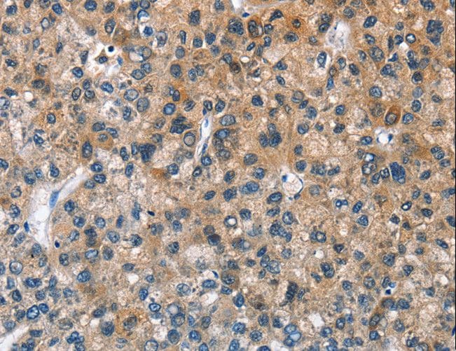 BPI Antibody