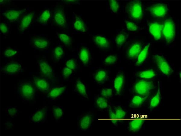 IHC-plus™ HIST1H3D Antibody (clone 1D8)