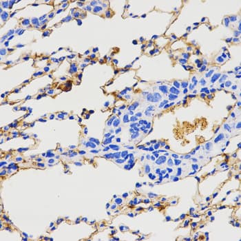 Polyclonal Rabbit anti-Human Neuropeptide Y / NPY Antibody (IHC, WB)
