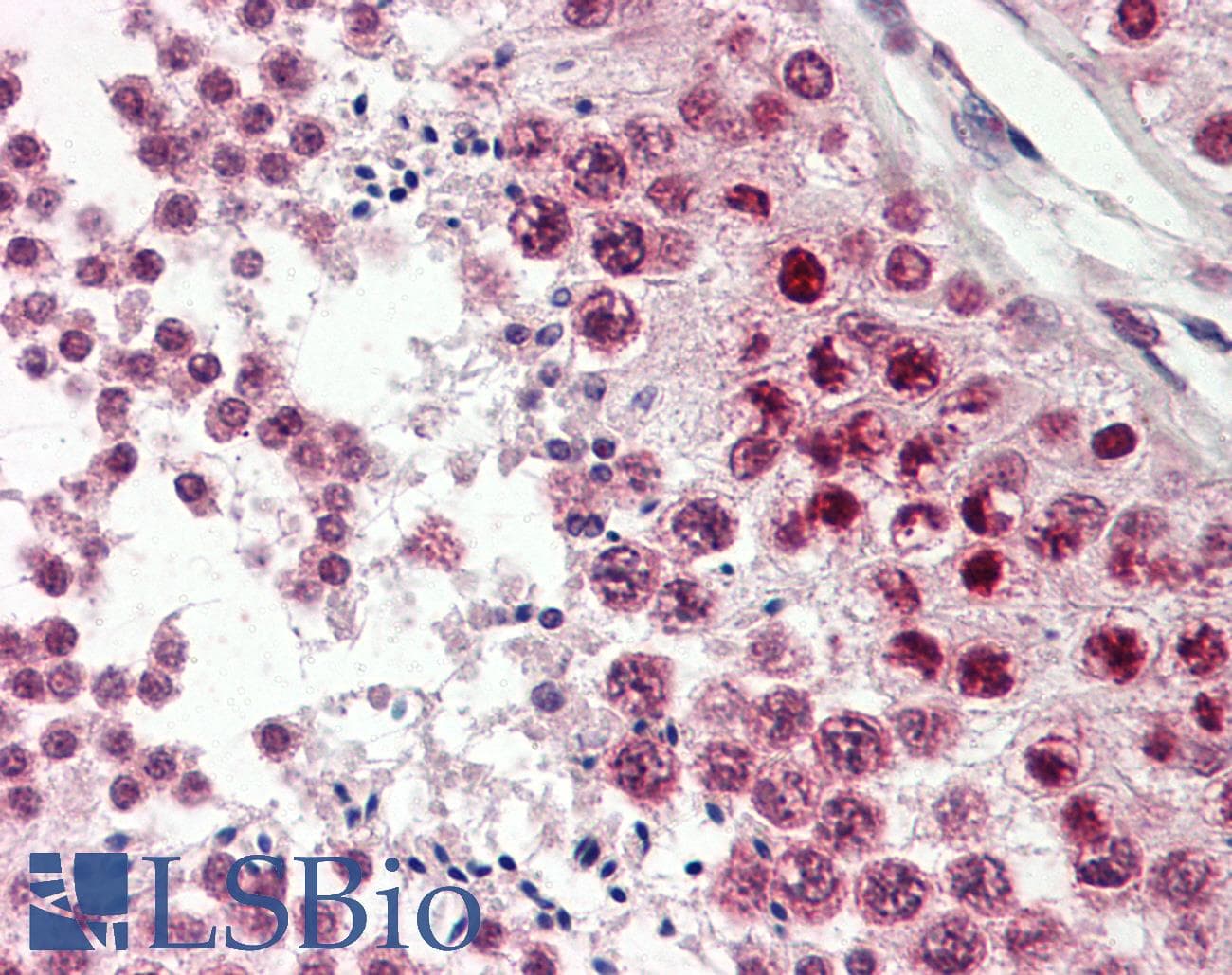 IHC-plus™ Polyclonal Goat anti-Human CIRP / CIRBP Antibody (aa161-172, IHC, WB)