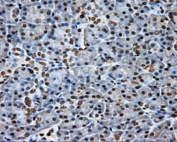 DAPK2 / DAP Kinase 2 Antibody (clone OTI1C5, Carrier-free)