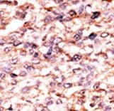ACVR1C / ALK7 Antibody (aa33-62)