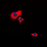 HSPB2 / HSP27 Antibody (C-Terminus)