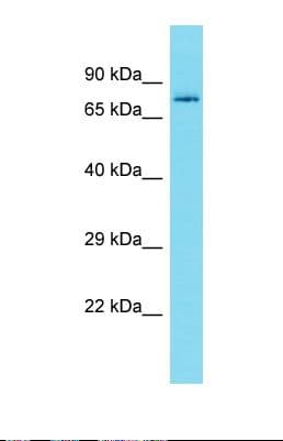 Polyclonal Rabbit anti-Human DCAF8 / WDR42A Antibody (aa490-539, WB)