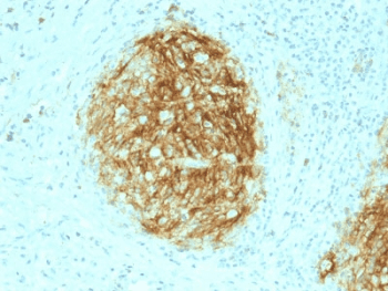 CR2 / CD21 Antibody (clone CR2/1953)
