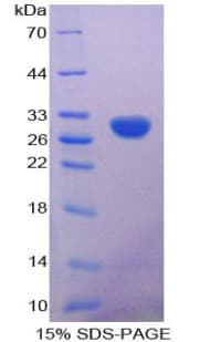 Human CALB2 / Calretinin Protein (Recombinant His-T7)