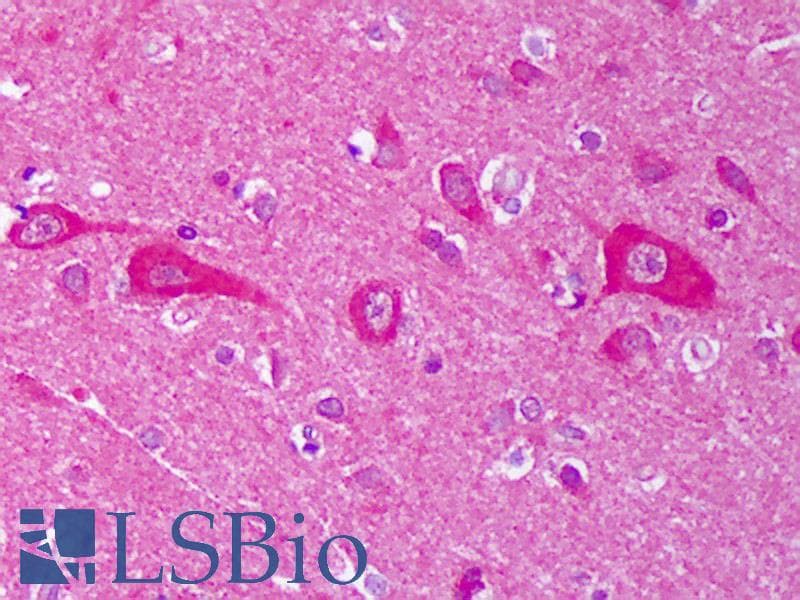 IHC-plus™ AHSA1 / AHA1 Antibody (clone 25F2.D9)