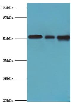 Polyclonal Rabbit anti-Human PDCD4 Antibody (aa1-260, WB)