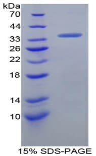 Human TFF1 / pS2 Protein (Recombinant His-GST)