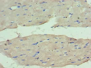 Polyclonal Rabbit anti-Human WDR77 / MEP50 Antibody (aa1-260, IHC, WB)