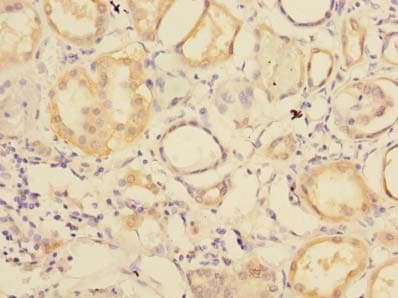 Polyclonal Rabbit anti-Human RNF181 Antibody (IHC)