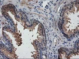 DSTN / Destrin Antibody (clone OTI1C8)