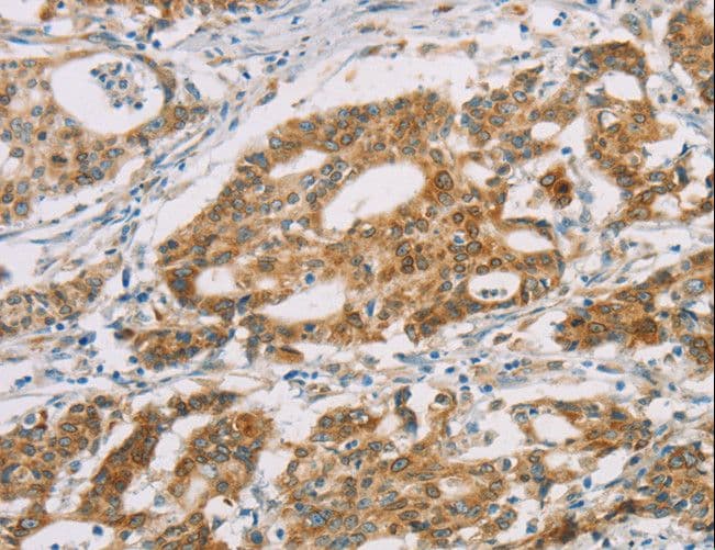 Polyclonal Rabbit anti-Human DMRTA3 / DMRT3 Antibody (IHC, WB)