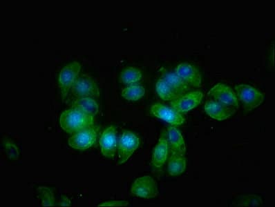 Polyclonal Rabbit anti-Human KLB / Beta Klotho Antibody (IHC)