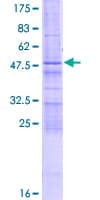 Human ZCCHC4 Protein (Recombinant GST)