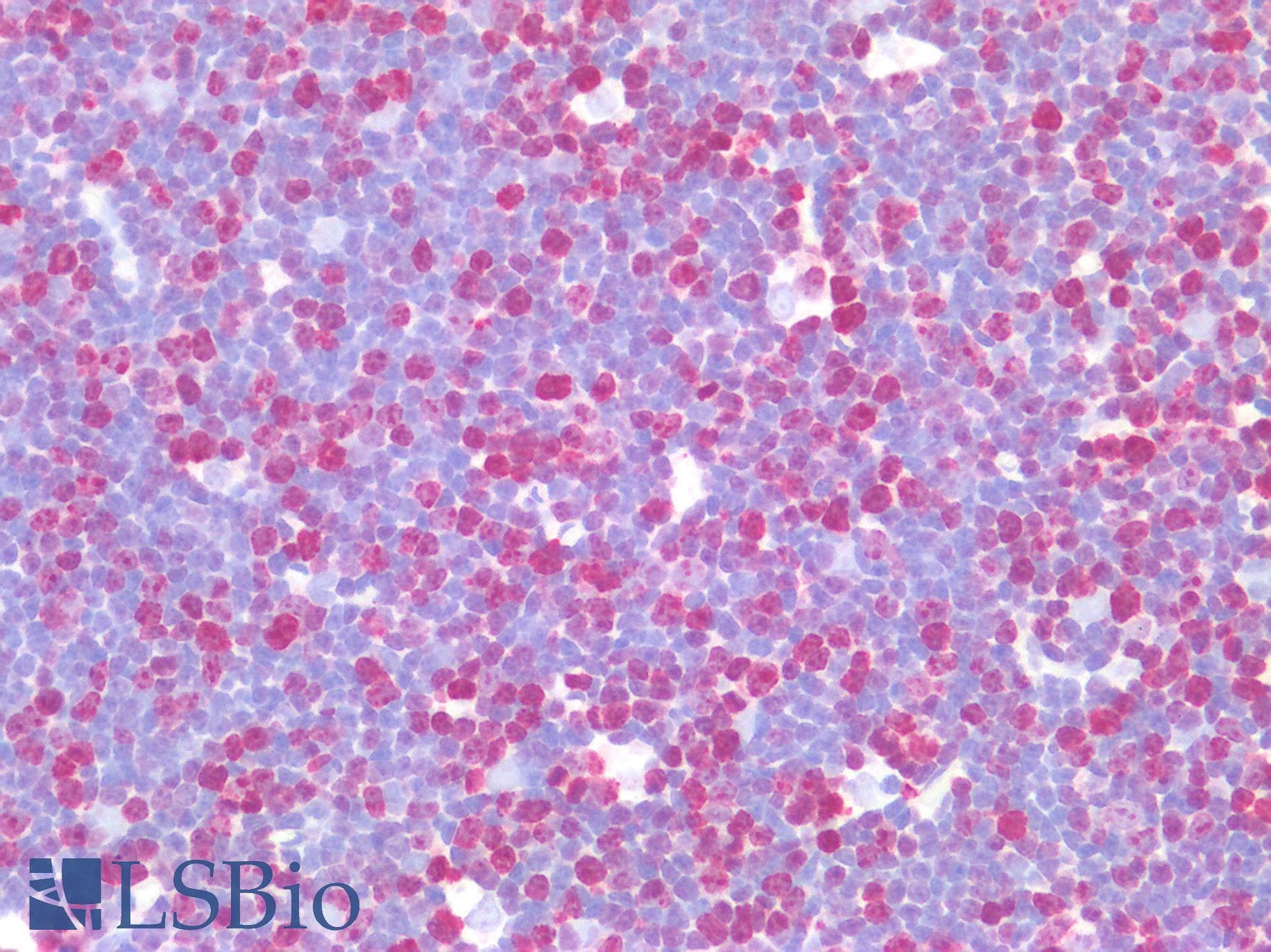 PathPlus™ MKI67 / Ki67 Antibody (clone 19, Preservative Free)