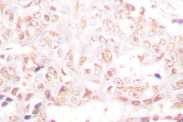 SENP8 Antibody (Thr191)