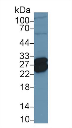 TNNI1 Antibody (aa1-187)
