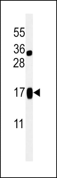 LIMD2 Antibody (aa84-113)