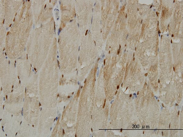 TTN / Titin Antibody (clone 2B3)