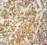 TEX9 Antibody (aa42-70)