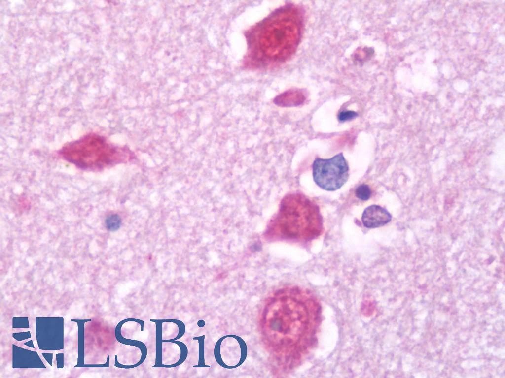 IHC-plus™ SKP1 Antibody (clone 1H9)