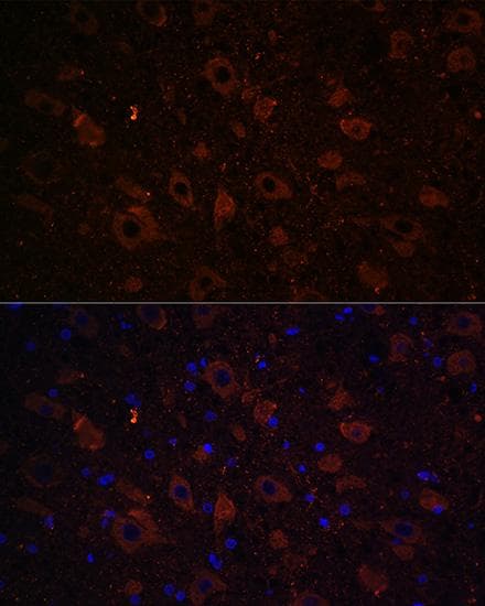 SLC6A3 / Dopamine Transporter Antibody
