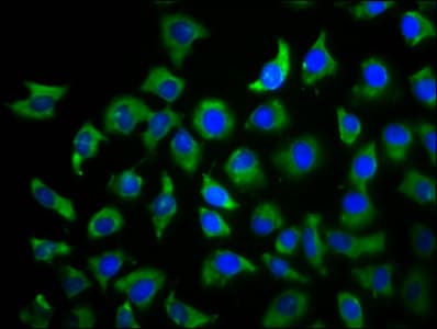 Polyclonal Rabbit anti-Human TBCD Antibody (IHC, IF)