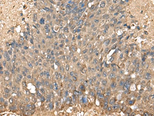 Polyclonal Rabbit anti-Human MRPL42 / MRPS32 Antibody (IHC, WB)