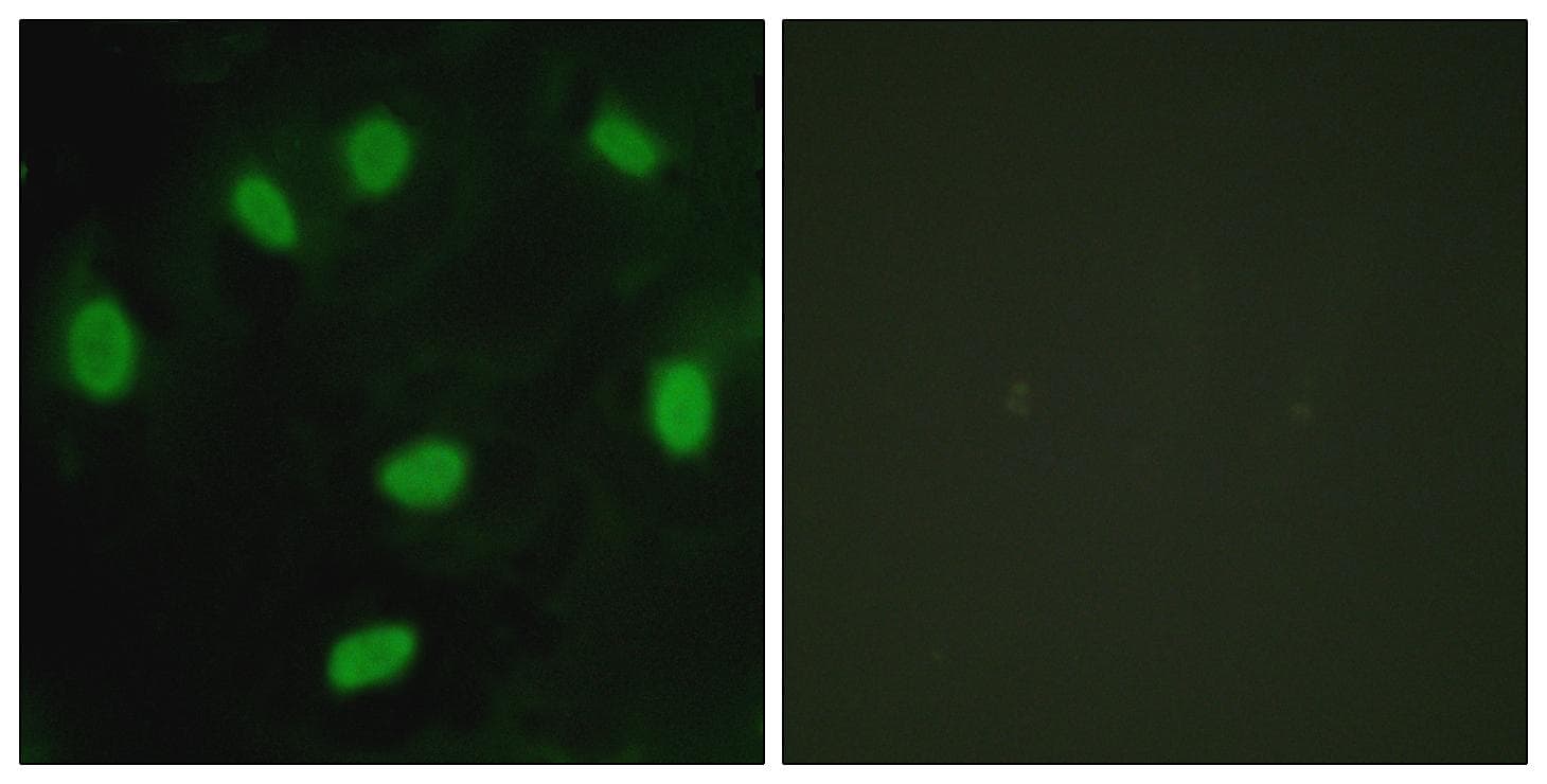 Polyclonal Rabbit anti-Human TBX15+18 Antibody (IHC, IF, WB)