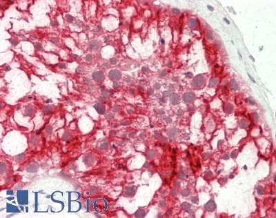 IHC-plus™ CLDN11 / Claudin 11 Antibody (aa158-207)