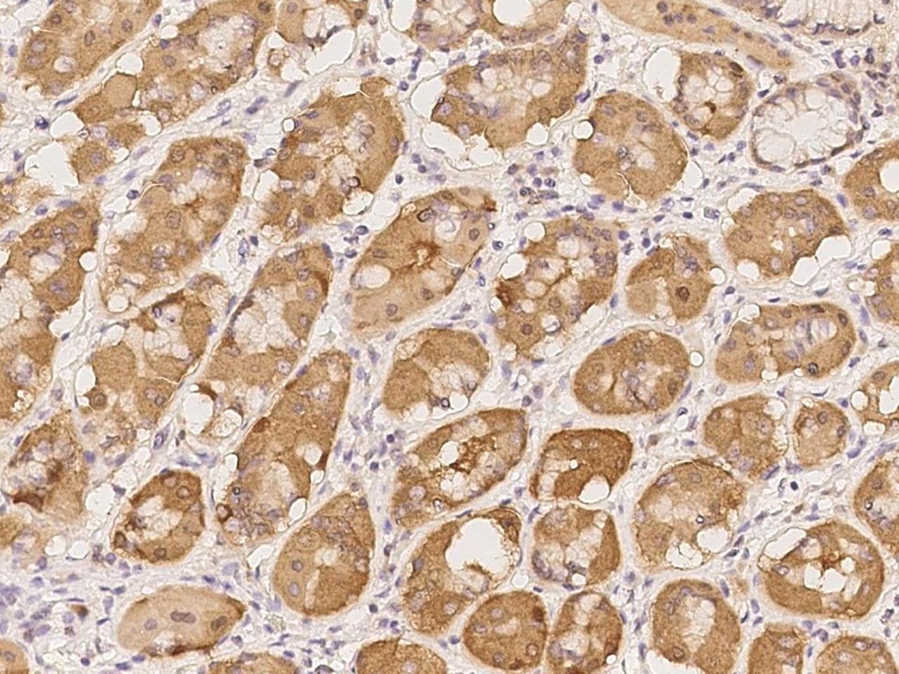 SNPH Antibody