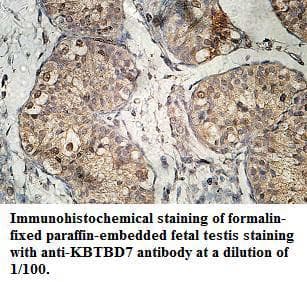 KBTBD7 Antibody (aa311-474)