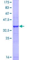 Human AVIL / Advillin Protein (Recombinant GST, N-terminus)