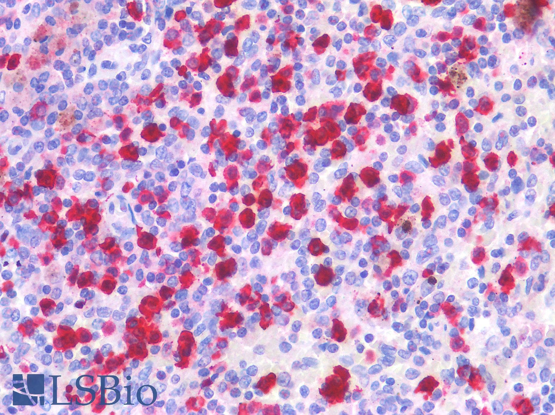 PathPlus™ BTLA / CD272 Antibody
