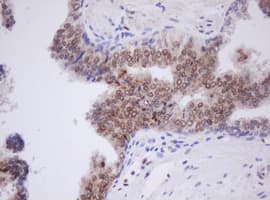 TLE1 / TLE 1 Antibody (clone OTI1A11)