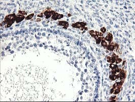 PTPN7 / HEPTP Antibody (clone OTI3G2)