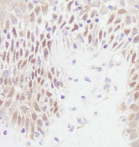 TP53 / p53 Antibody (aa375-C-term)