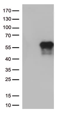 Monoclonal Mouse anti-Human HAVCR2 / TIM-3 Antibody (clone OTI1B10, Carrier-free, WB)