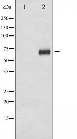 RPS6KB1 / P70S6K / S6K Antibody (phospho-Ser411)