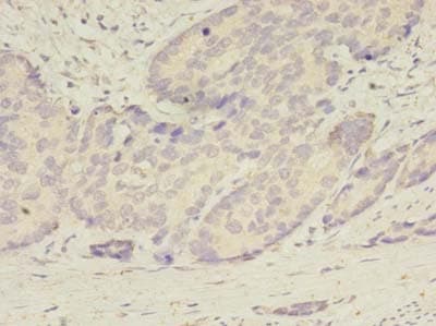 Polyclonal Rabbit anti-Human ATG2B Antibody (IHC)