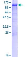 Human GGA3 Protein (Recombinant GST)