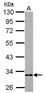 Polyclonal Rabbit anti-Human HIBADH Antibody (IHC, WB)