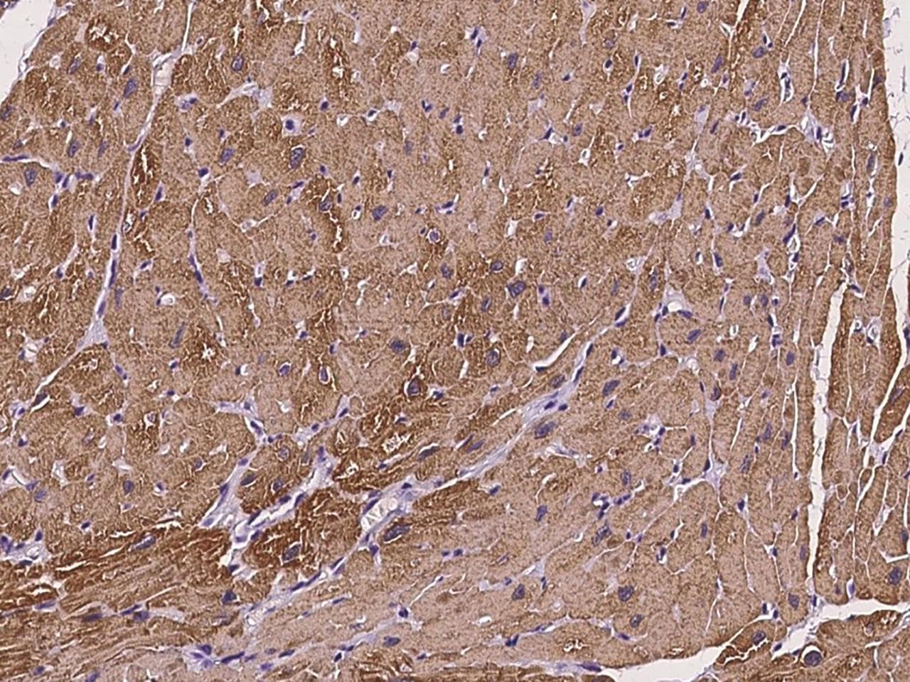 TNNC1 / Cardiac Troponin C Antibody