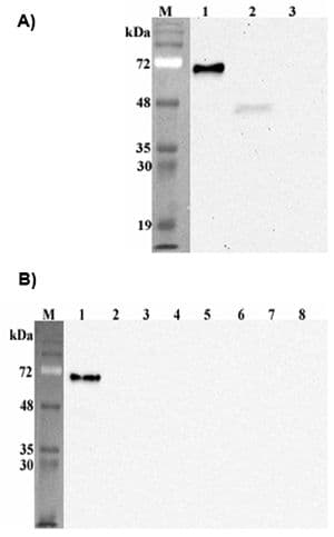 IHC-plus™ DLK1 / Pref-1 Antibody (Extracellular Domain, clone PF13-3)