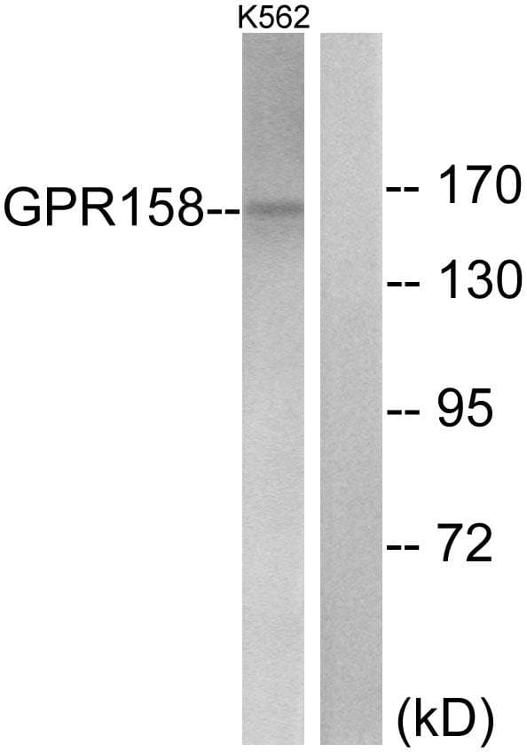 GPR158 Antibody