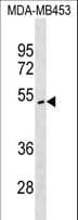 ITPK1 Antibody (aa28-54)