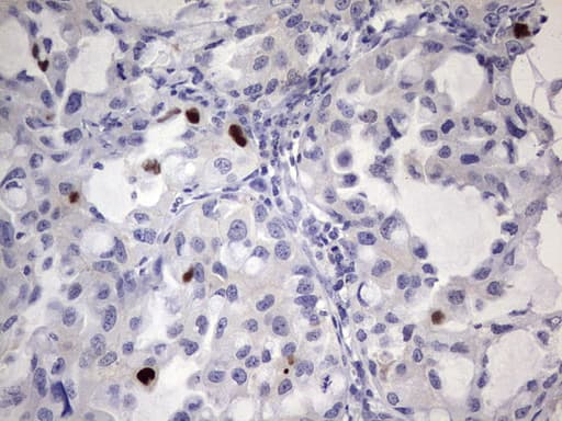 Monoclonal Mouse anti-Human MDM2 Antibody (clone OTI7F7, aa119-438, IHC, WB)