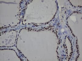MGMT Antibody (clone OTI1B12)