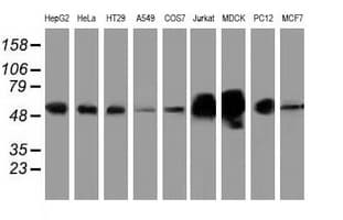 ERGIC-53 / LMAN1 Antibody (clone OTI1A8)